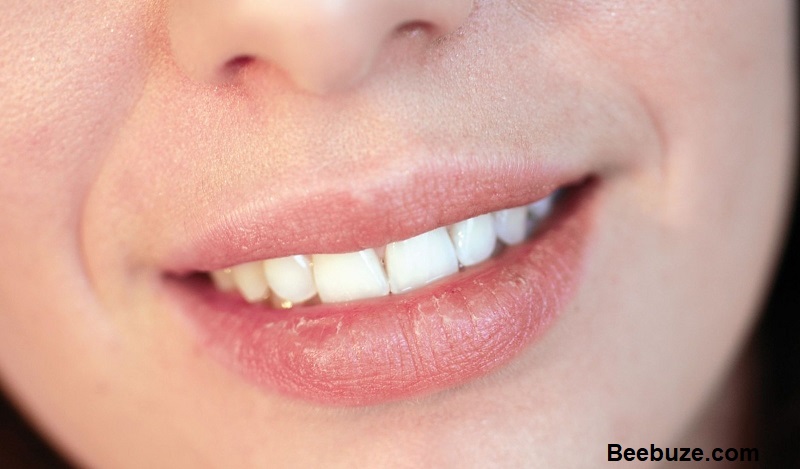 Home Remedies For Cracked Lips